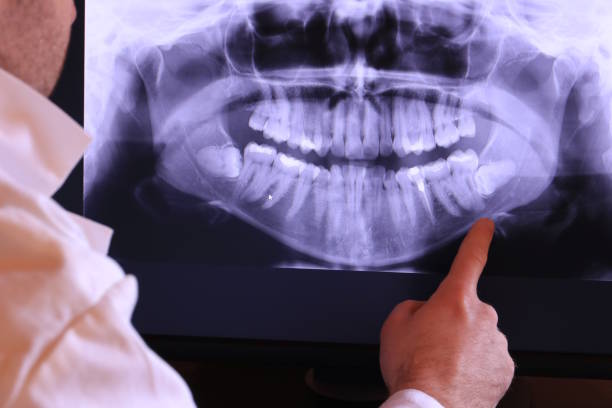 Best Weekend Emergency Dental Services in Louisville, OH