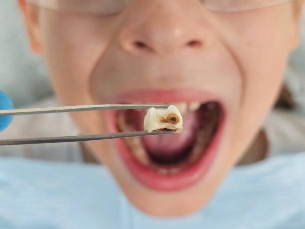 Best Emergency Pediatric Dental Care in Louisville, OH